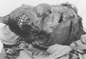 Mummy of Pharaoh Seqenenre Tao II with battle wounds to the head